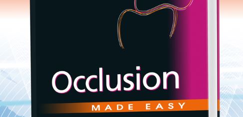 Occlusion Made Easy